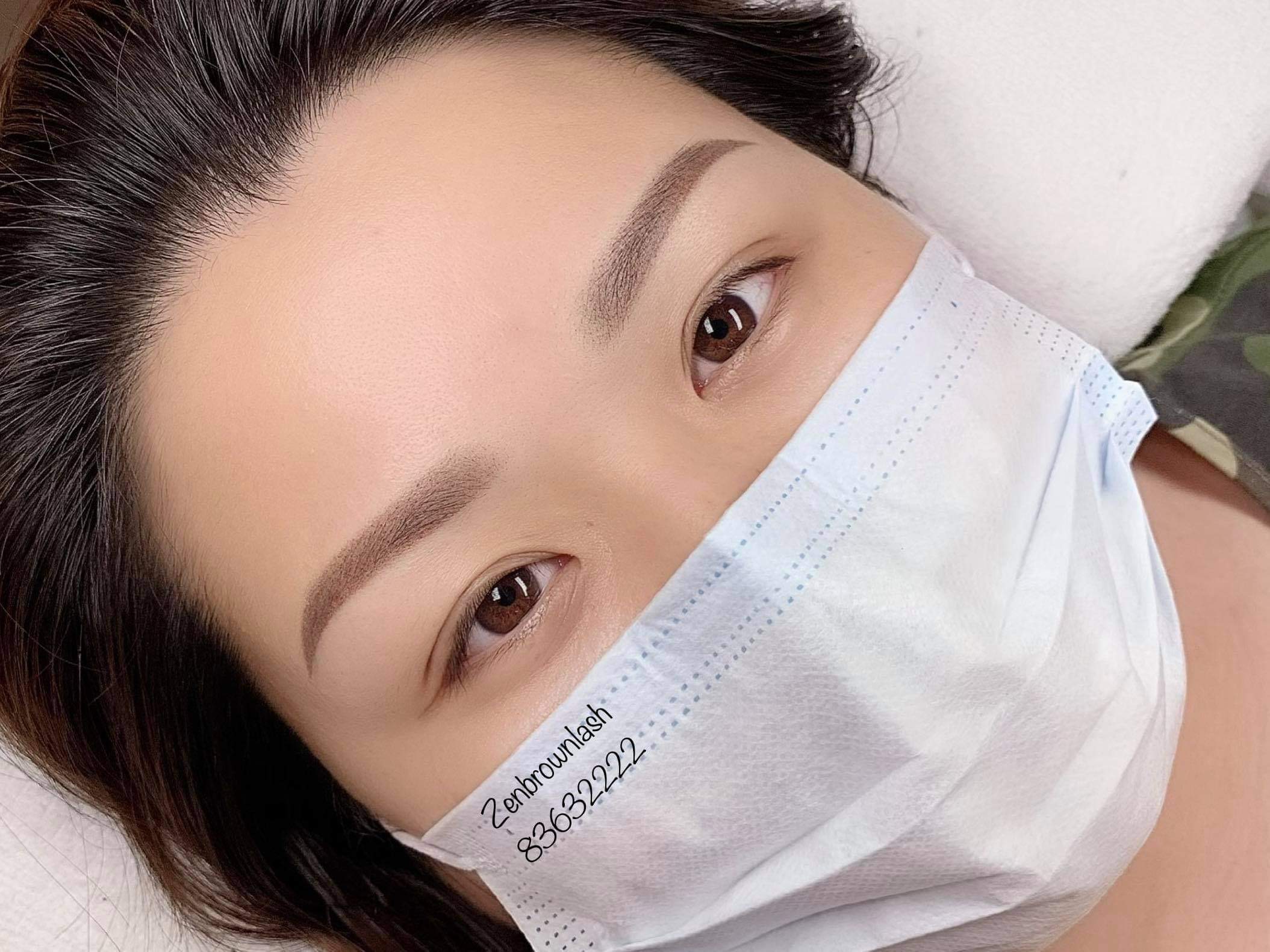 Beauty treatment result 1