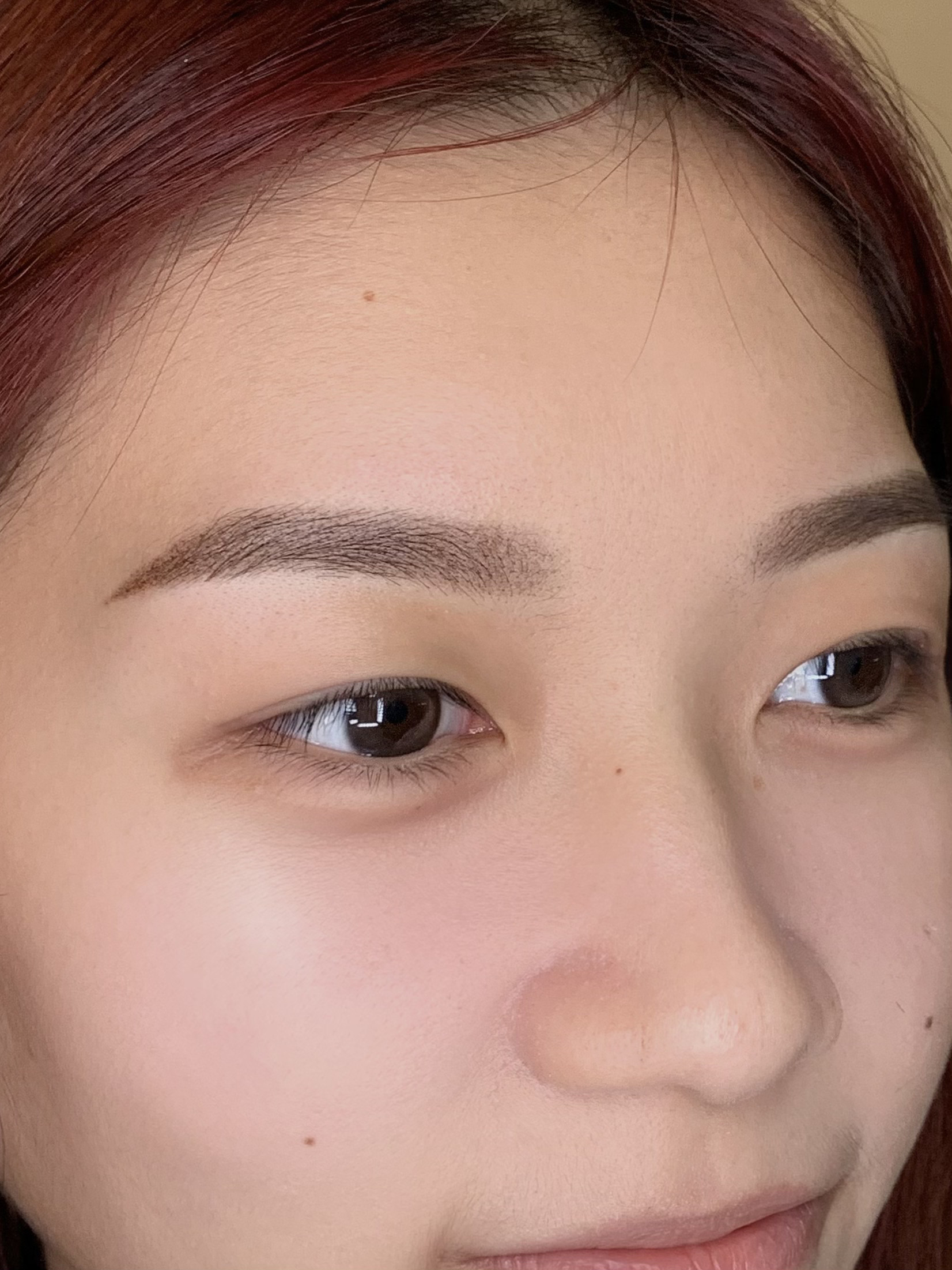 Beauty treatment result 4