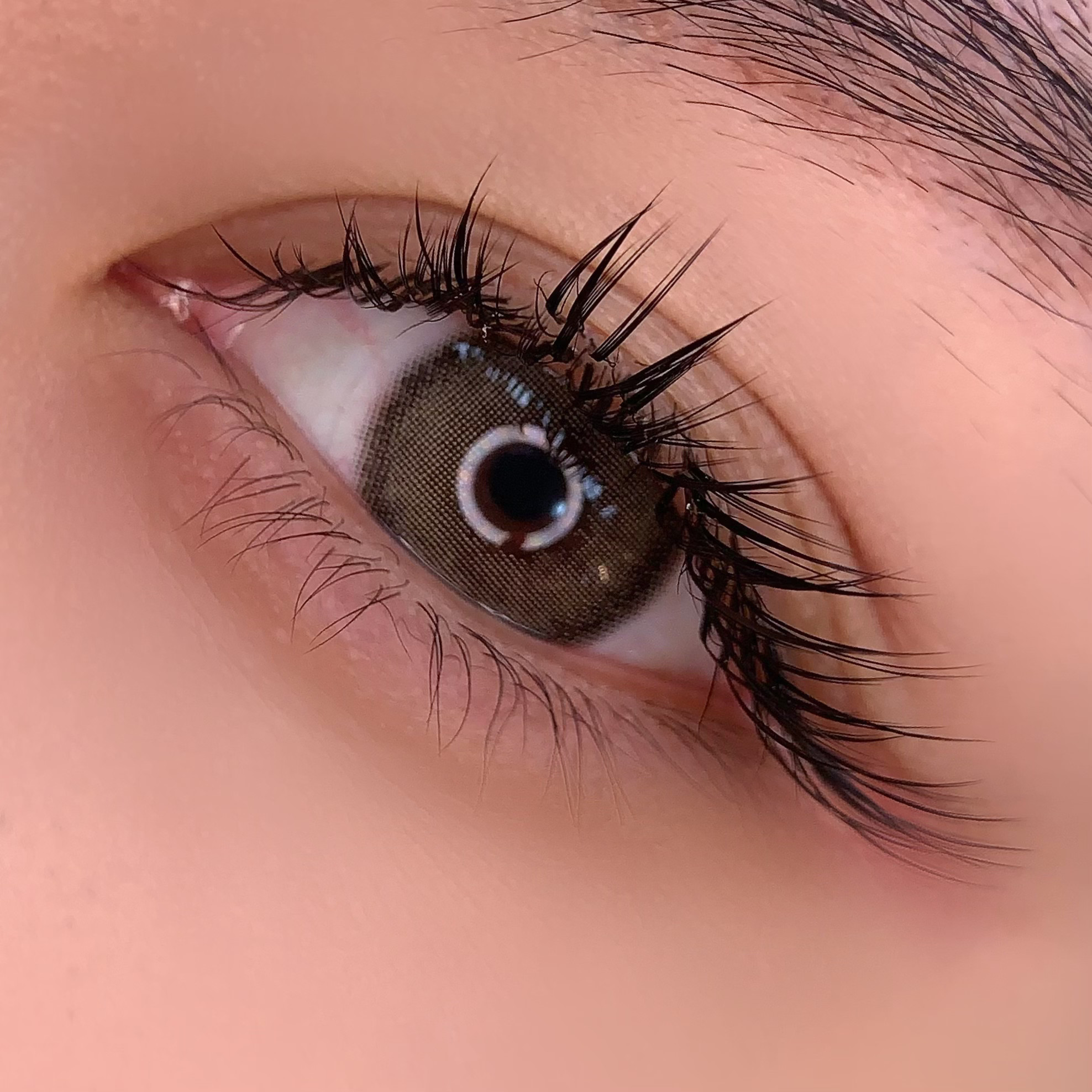 Beauty treatment result 6