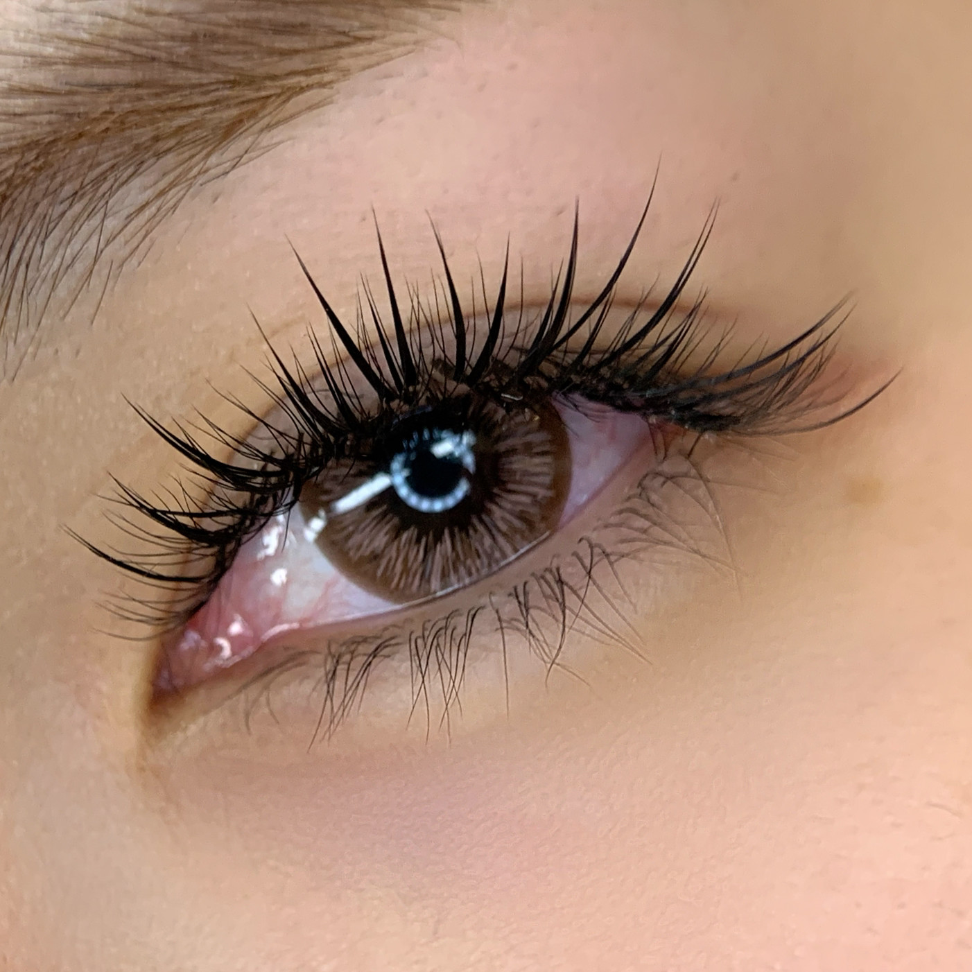 Beauty treatment result