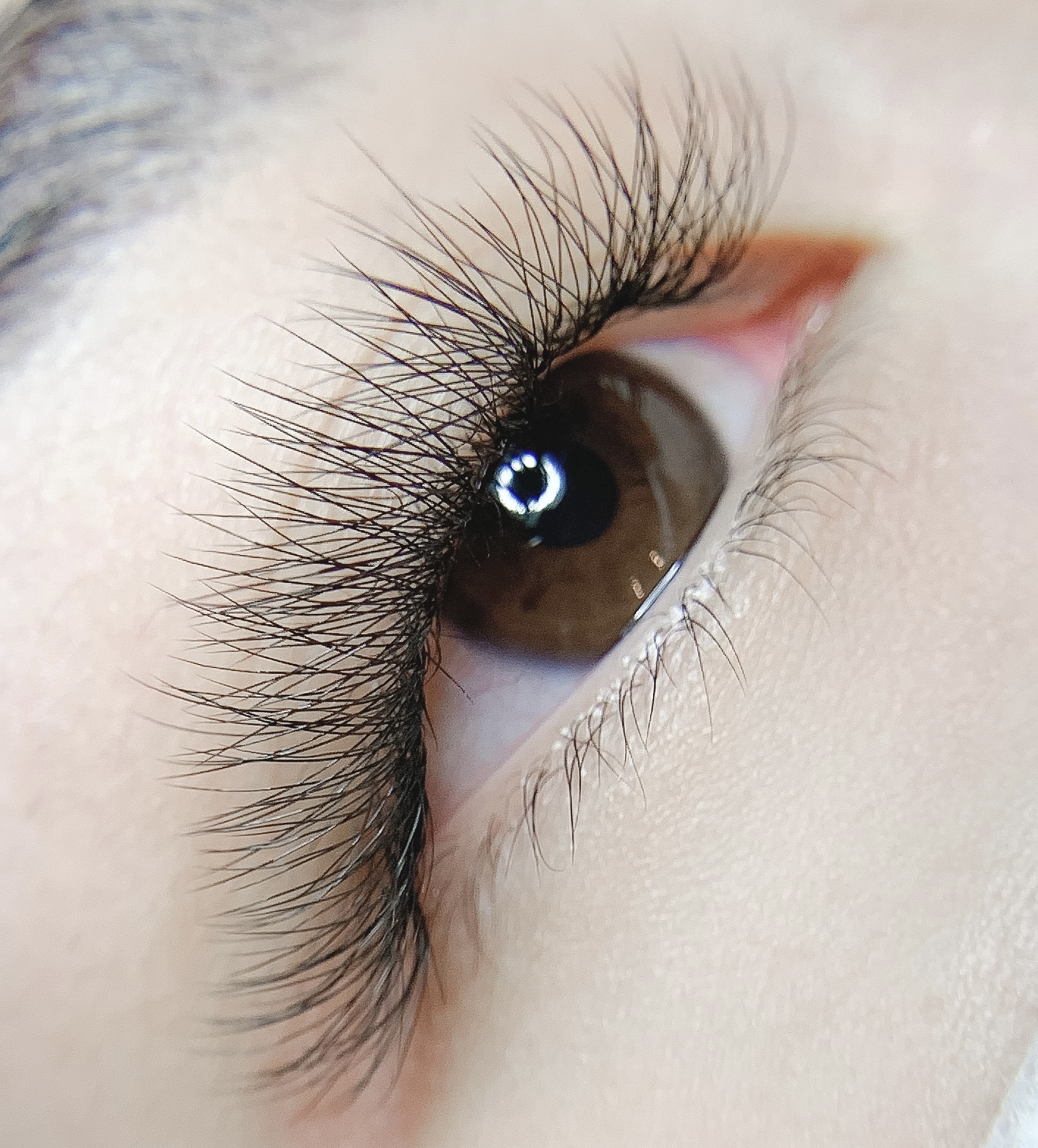 Beauty treatment result