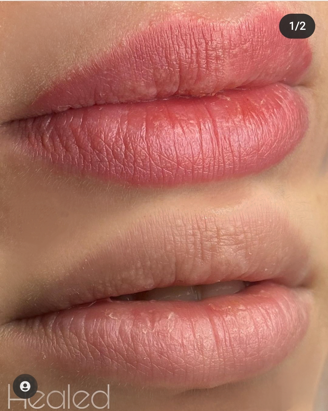 Beauty treatment result