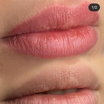 LIPS BLUSH (2 sessions)